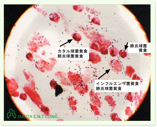 グラム染色検査