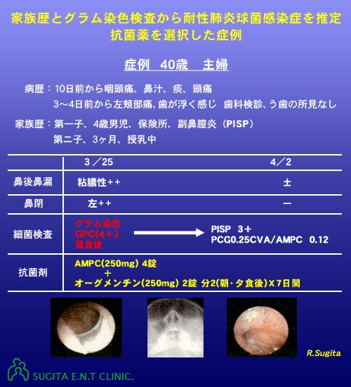 実際の症例