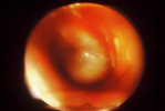 img_ear_02 (1)